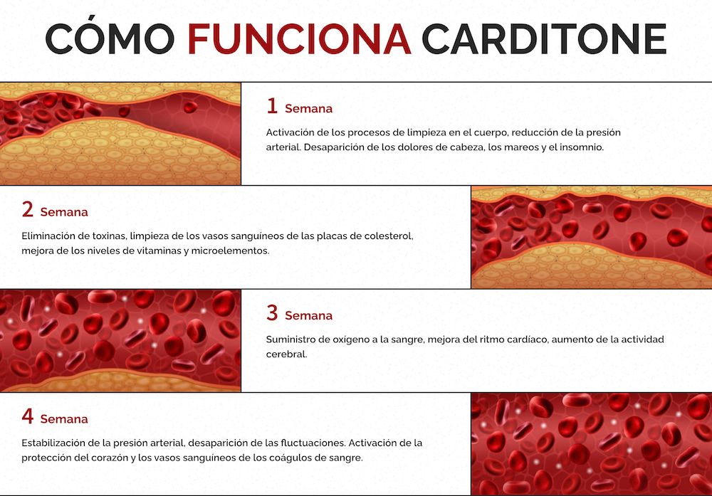 carditone como funciona