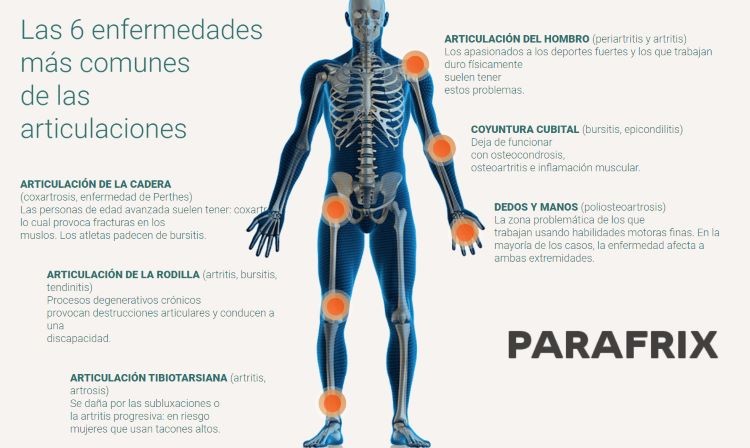 como-funciona-parafrix